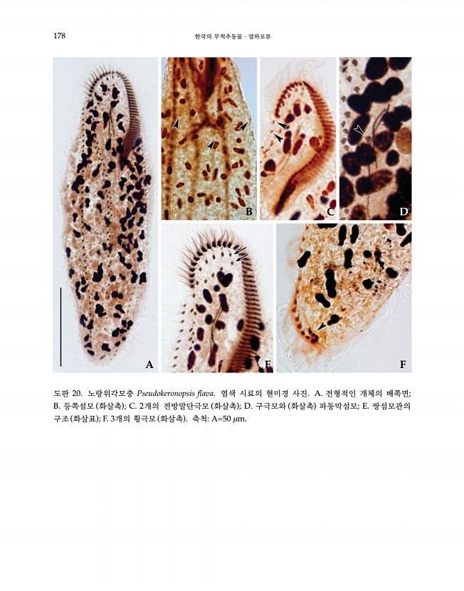 178페이지